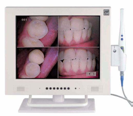 INTRAORAL KAMERA (AUTOFOKUS)